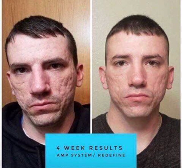Rodan + Fields Before and After Photo Stories 