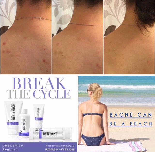 Rodan + Fields Before and After Photo Stories 